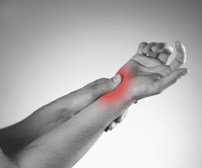 Carpal Tunnel Syndrome Indianapolis